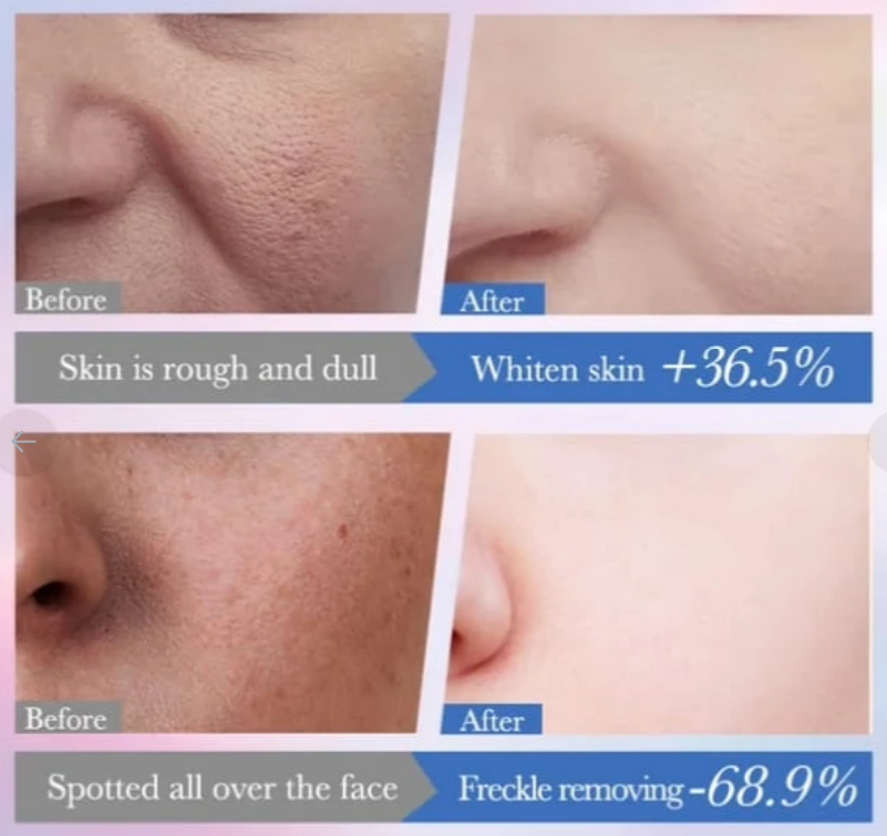 10% Niacinamide Spot Removal Repair Serum