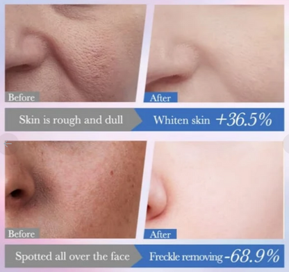 10% Niacinamide Spot Removal Repair Serum