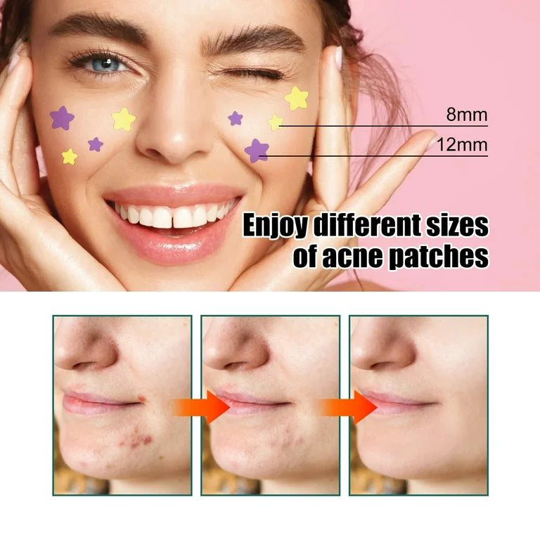 Sadoer Stars Pimple Patch – Colorful Hydrocolloid Acne Stickers for Quick Healing (40 Patches)