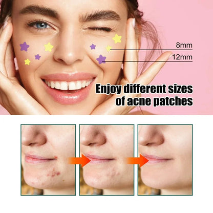 Sadoer Stars Pimple Patch – Colorful Hydrocolloid Acne Stickers for Quick Healing (40 Patches)
