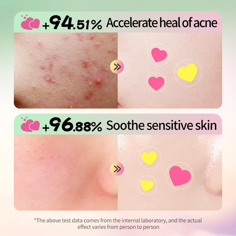 Colored Hydrocolloid Acne Patch – Heart, Star & Round Series